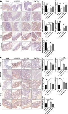 Qingchang Wenzhong Decoction Prevents the Occurrence of Intestinal Tumors by Regulating Intestinal Microbiota and Gasdermin E